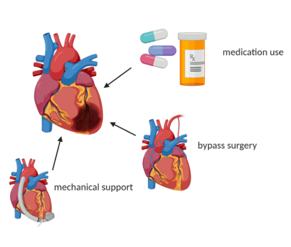 Heart Disease Prevention