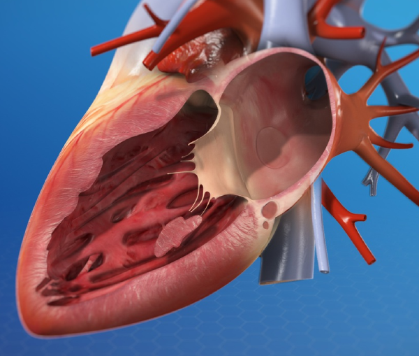 Mitral Valve Repair