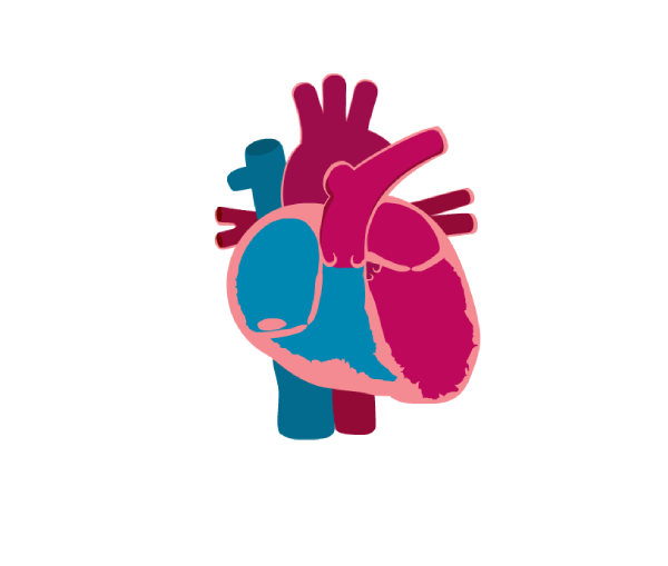 Dilated Cardiomyopathy